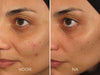 Iluma - Intense Facial Illuminator (30ml)